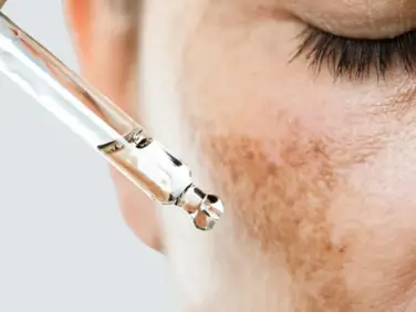 Melanin OFF – Protocol Melasma / Hyperpigmentation – Belissima Clinic Dublin - 4