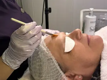 Special Protocol – Luxury Dermaplaning with deep cleansing and mineral mask – Belissima Clinic Dublin - 8